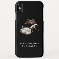 Schwangerschaft Baby Sonogramm Ultrasound Foto