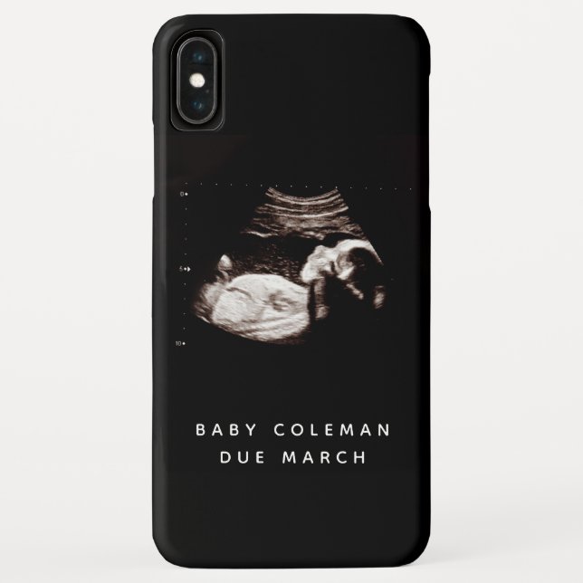 Schwangerschaft Baby Sonogramm Ultrasound Foto Case-Mate iPhone Hülle (Rückseite)
