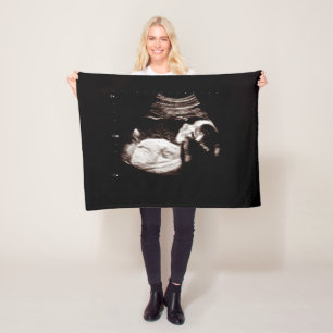 Schwangerschaft Keepake Baby Ultrasound Sonogramm  Fleecedecke