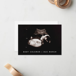 Schwangerschaft Reveal Baby Ultrasound Sonogramm F Mitteilungskarte