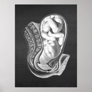 Schwangerschaft Womb Anatomie Obstetrische Dekorat Poster