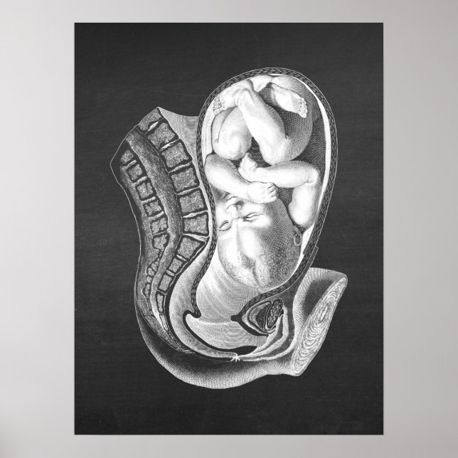 Schwangerschaft Womb Anatomie Obstetrische Dekorat Poster (Vorne)