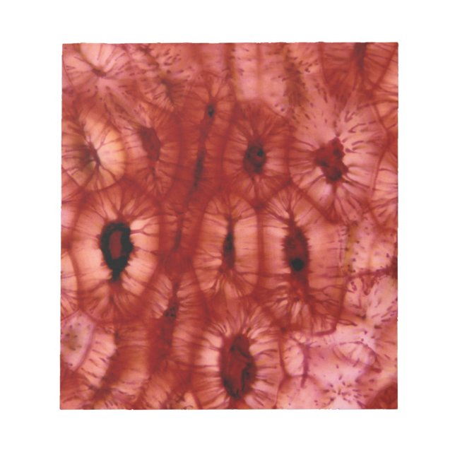 Sclerenchyma Zellen aus der Kirschgrube Notizblock (Vorderseite)