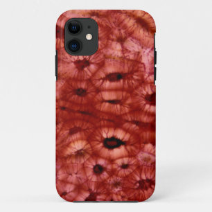 Sclerenchyma Zellen von einer Kirschgrube Case-Mate iPhone Hülle