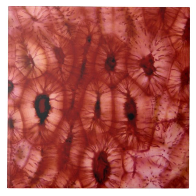 Sclerenchyma Zellen von einer Kirschgrube Fliese (Vorderseite)