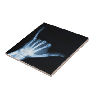 Shaka Sign X-Ray (Hang Loose) Fliese