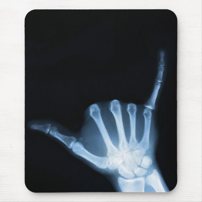 Shaka Sign X-Ray (Hang Loose) Mousepad (Vorne)