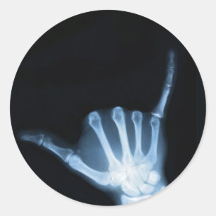 Shaka Sign X-Ray (Hang Loose) Runder Aufkleber