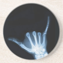 Shaka Sign X-Ray (Hang Loose)
