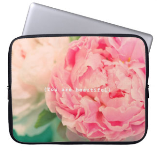 Sie sind schön laptopschutzhülle