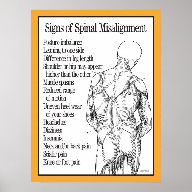 Signs of Spinal Misalignment Poster (Vorne)