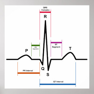 Sinusrhythmus in einem EKG-EKG-Diagramm Poster