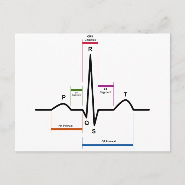 Sinusrhythmus in einem EKG-EKG-Diagramm Postkarte (Vorderseite)