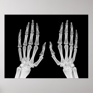 Skeleton Hands Xray Picture Human Anatomy Foto Poster