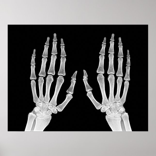 Skeleton Hands Xray Picture Human Anatomy Foto Poster (Vorne)