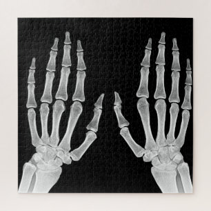 Skeleton Hands Xray Picture Human Anatomy Foto Puzzle