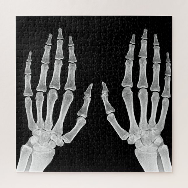 Skeleton Hands Xray Picture Human Anatomy Foto Puzzle (Vertikal)