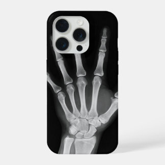 Skeleton iPhone 15 Pro-Hülle Pro Hülle