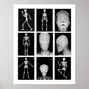 Skelett Skull Human Body XRAYS Collage Art Poster