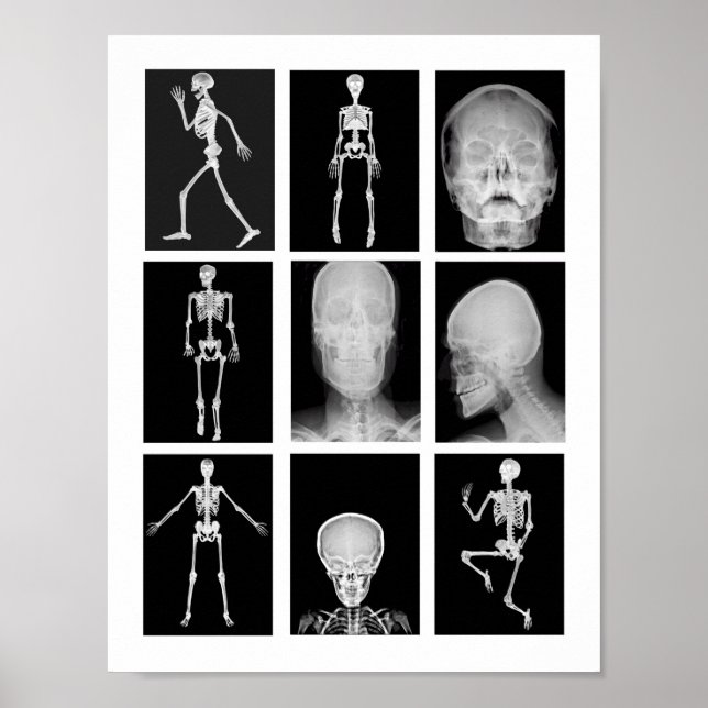 Skelett Skull Human Body XRAYS Collage Art Poster (Vorne)