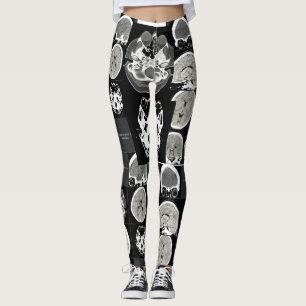 So sieht Depressionen aus Leggings