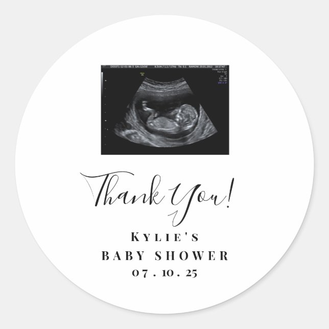 Sonogram Baby Shower Stickers (Vorderseite)