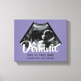 Sonogram Keepake Baby Ultrasound Canvas Print Leinwanddruck