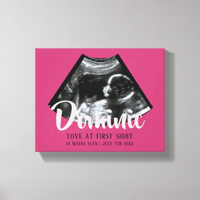 Sonogram Keepake Baby Ultrasound Canvas Print Leinwanddruck (Vorderseite)