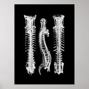 Spine Anatomie Art Poster