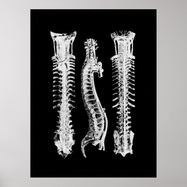 Spine Anatomie Art Poster (Vorne)