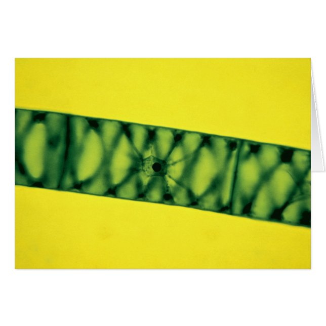 Spirogyra Green Algae (Vorderseite (Horizontal))