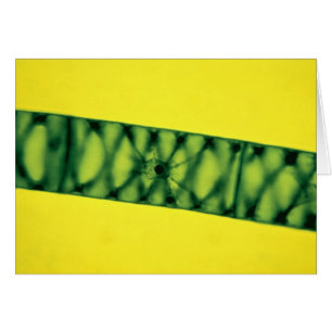 Spirogyra grüne Algen