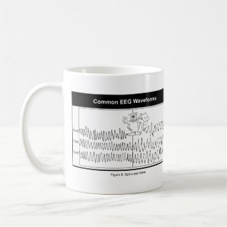 Spitzen-und Wellen-Kaffee-Tasse Tasse