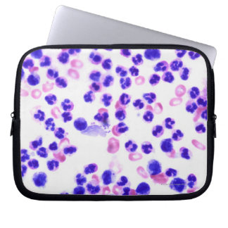 Staph Laptopschutzhülle