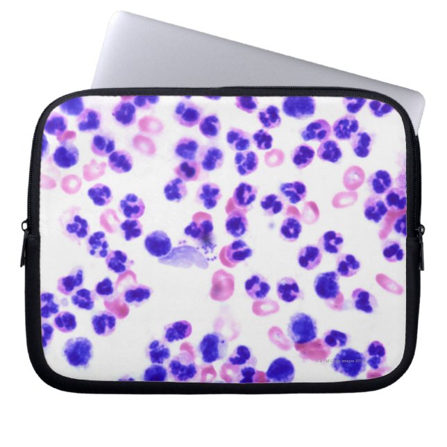 Staph Laptopschutzhülle (Vorderseite)