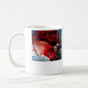 Steigende Aortenzerlegung Tasse