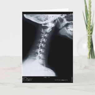 Strahl X der Halswirbel einschließlich unteren Karte