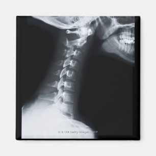 Strahl X der Halswirbel einschließlich unteren Magnet