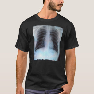 Strahln-T - Shirt des Kasten-X