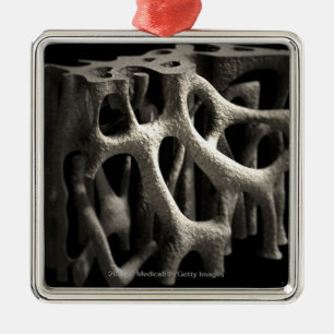 Struktur eines Knochens mit Osteoporose Ornament Aus Metall