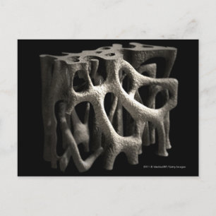 Struktur eines Knochens mit Osteoporose Postkarte