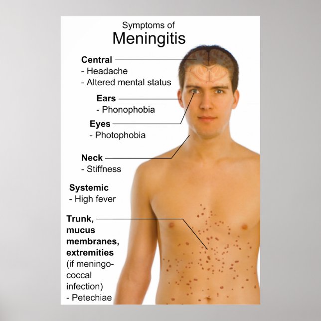 Symptomdiagramm der Entzündungskrankheit Meningiti Poster (Vorne)