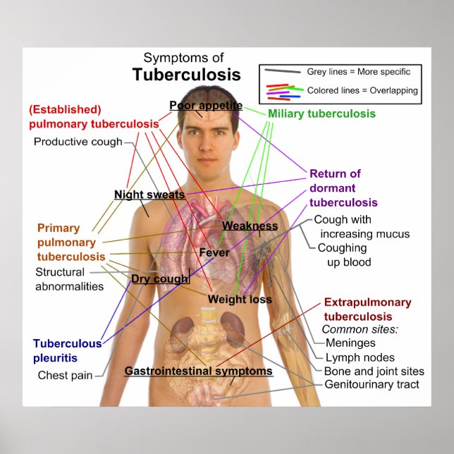 Symptomdiagramm der Tuberkulose beim Menschen Poster (Vorne)