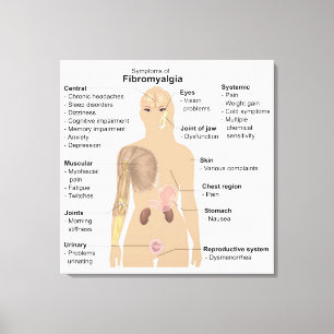 Symptome Fibromyalgie Canvas Print Leinwanddruck