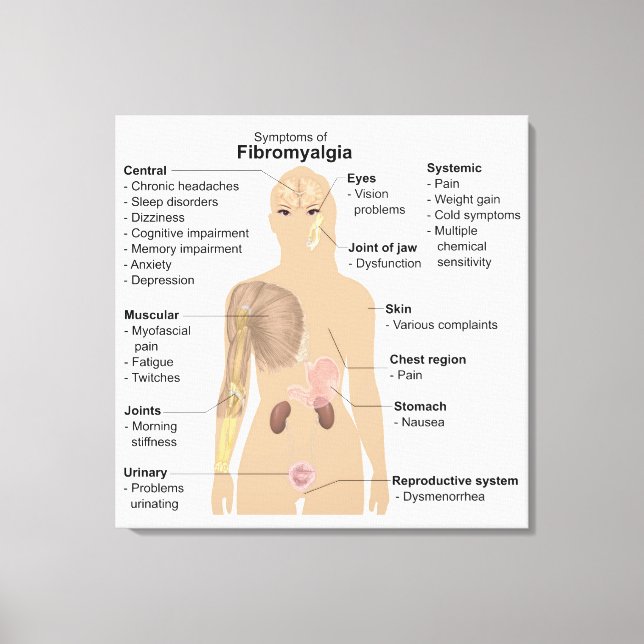 Symptome Fibromyalgie Canvas Print Leinwanddruck (Vorderseite)