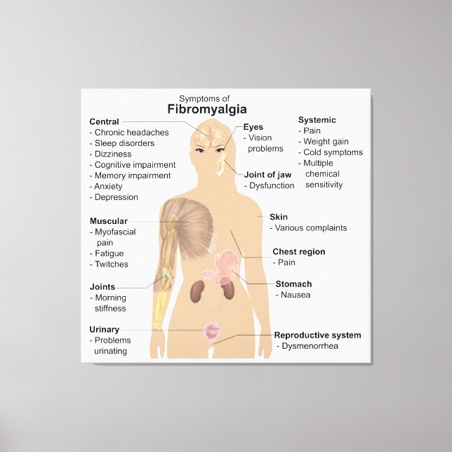 Symptome Fibromyalgie Canvas Print Leinwanddruck (Vorderseite)