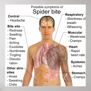 Symptoms Common in Poisonous Spider Bites Chart Poster