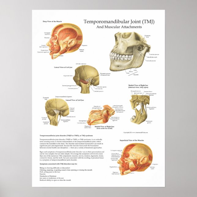 TMJ Anatomie Muskelanatomie Diagramm Arzt Poster (Vorne)