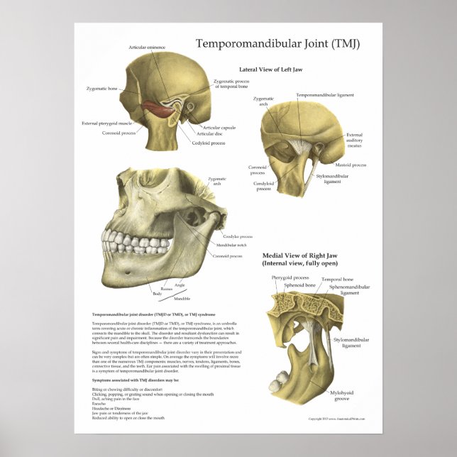 TMJ Joint Syndrome Anatomy Medical Poster (Vorne)