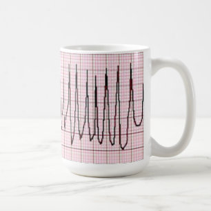 Torsades Tasse